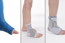 Cast vs Ankle Splint vs Ankle Brace: What’s the Difference?