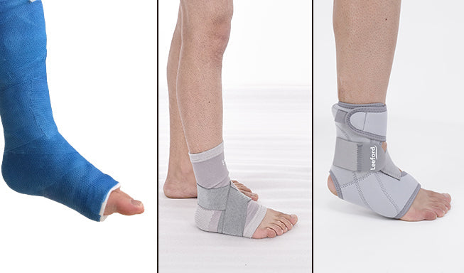 Cast vs Ankle Splint vs Ankle Brace: What’s the Difference?