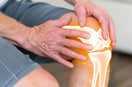 person suffering with Knee Osteoarthritis