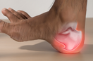 Plantar Fasciitis Pain