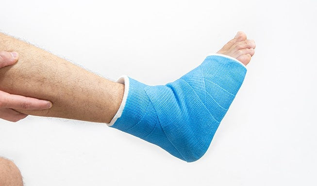 person showing his fractured ankle with plaster