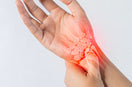 hand fractures