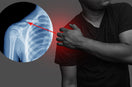 person suffering with Shoulder Clavicle Anatomy pain