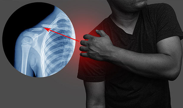 person suffering with Shoulder Clavicle Anatomy pain