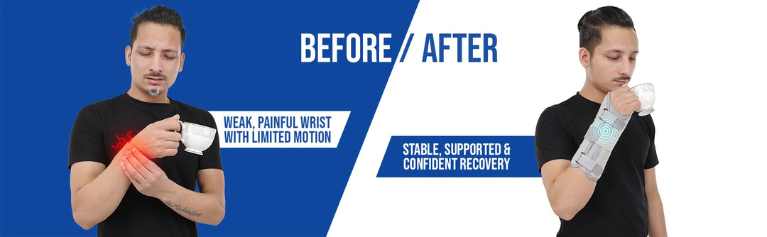 Before and after comparison of a leeford wrist and forearm splint 