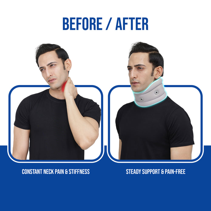 cervical collar before and after use effects