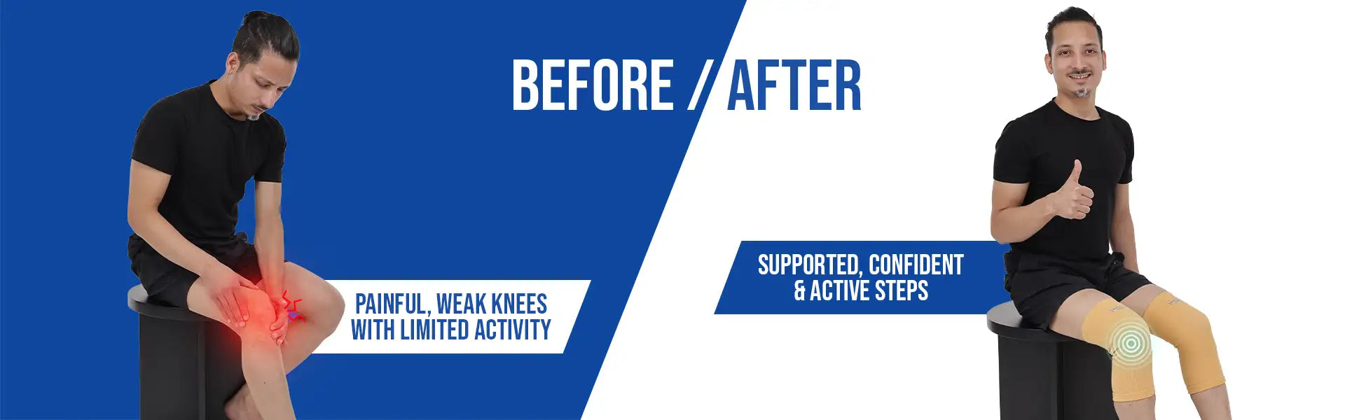 before and after effects of plain knee cap
