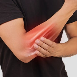 Arm