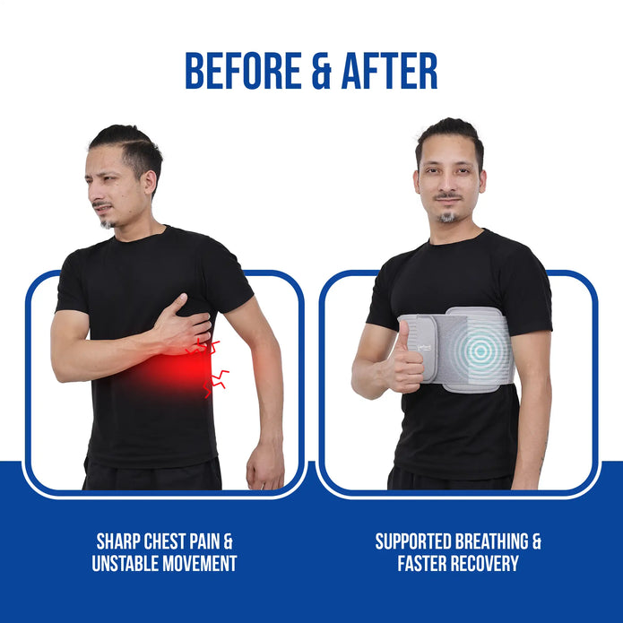 Before and after comparison of a person using a rib belt