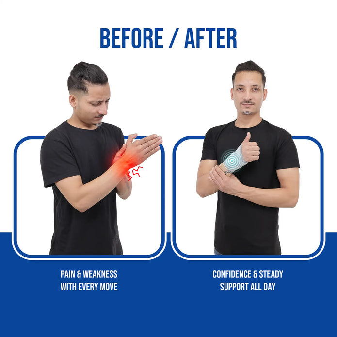 Before and after comparison of wrist brace