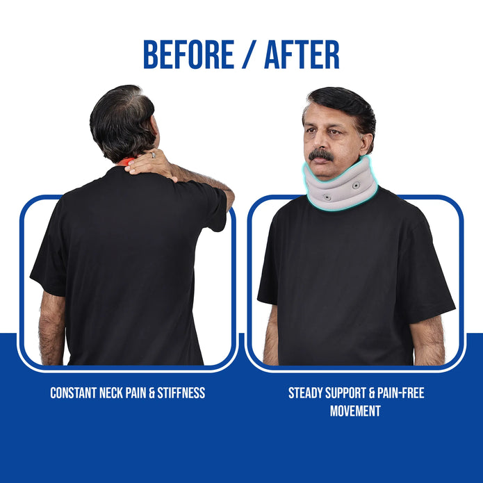 Cervical Collar | Reduces Pain, Provides Support for Neck Alignment