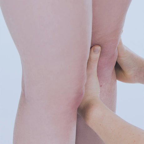 Chronic Knee Instability or Pain