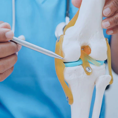 Osteoarthritis or Tendomyopathy