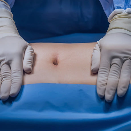 Post abdominal surgery