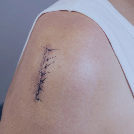 Post-Operative Recovery