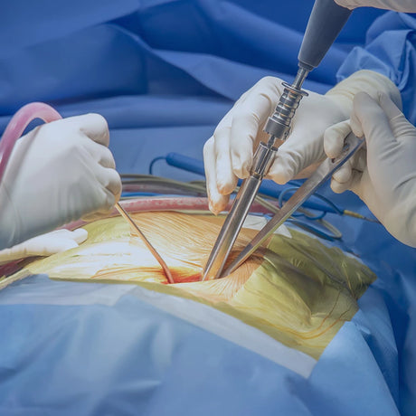 Post-Surgical Recovery