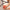 Tennis Elbow