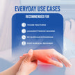thumb spica splint used for thumb fractures and more